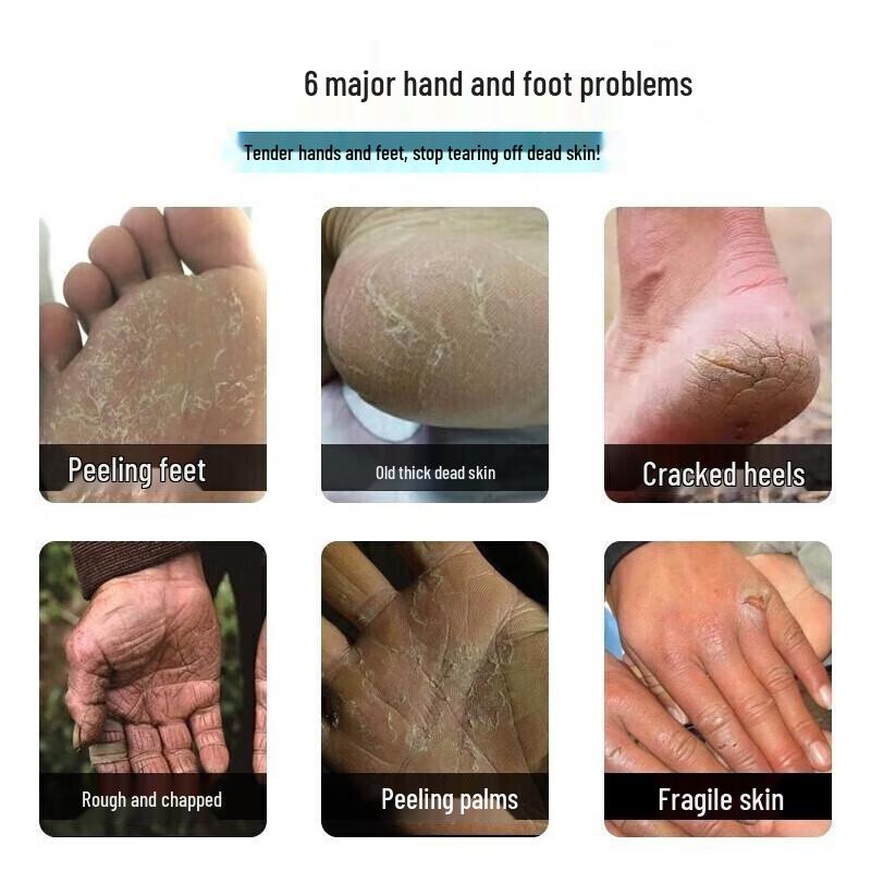 Longrich Snake Oil Fruit Acid Hand Cream