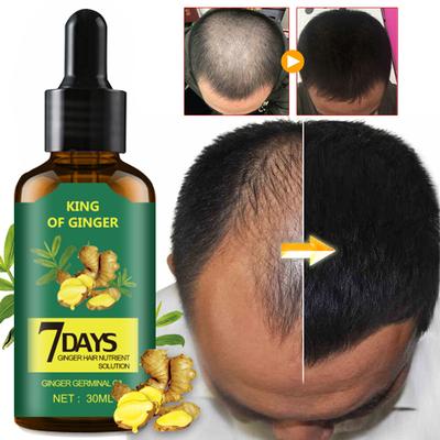 Ginger Hair Nutritional Solution Ginger King Ginger Hair Liquid Old Ginger King Hair Care Oil