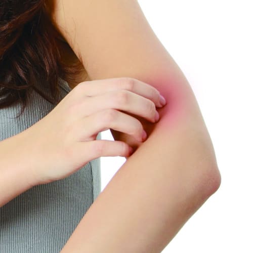 [Category 3 drug] Yuskin heat rash cream 32g