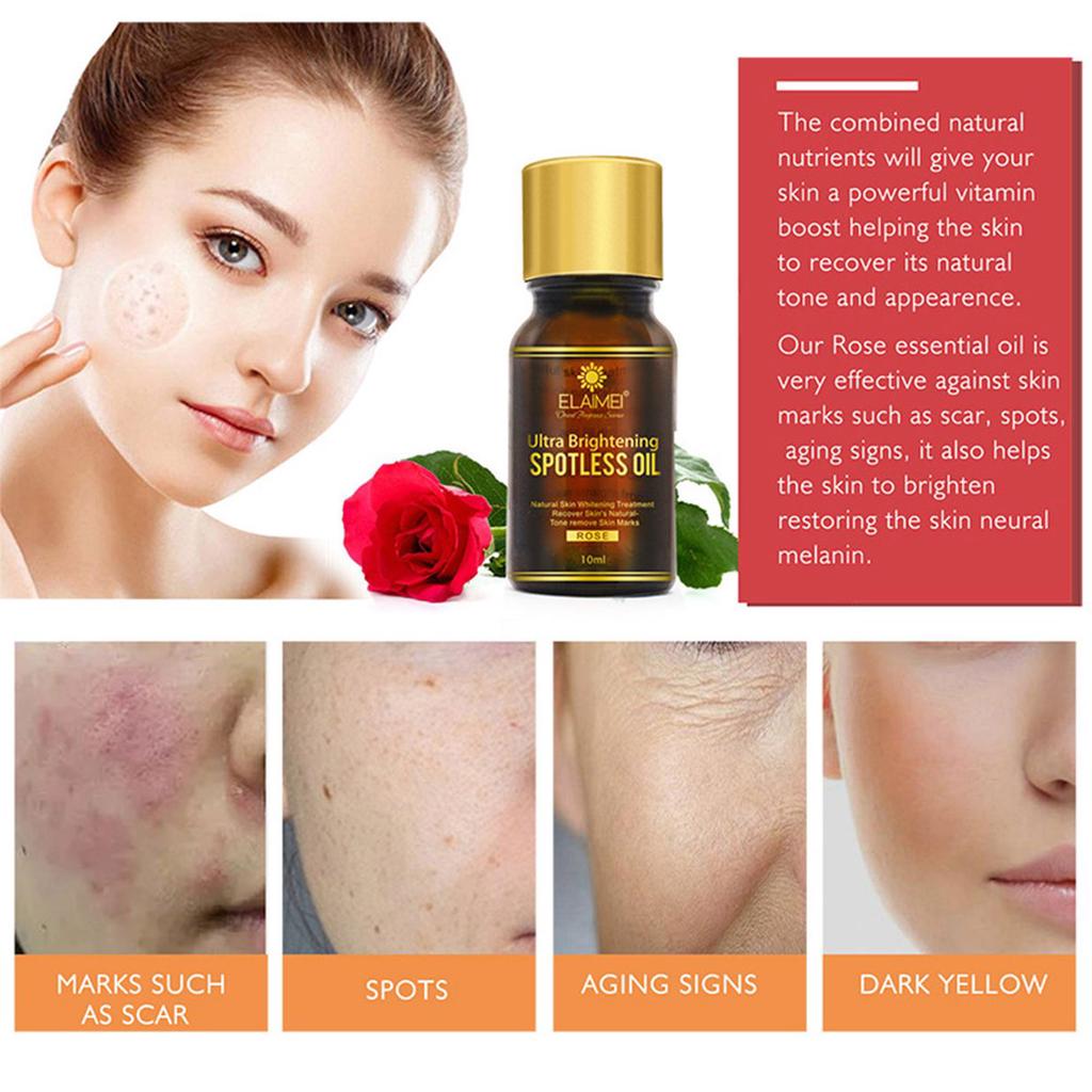 10ml Rose Flowers Essential Oil Brightening Whitening Spotless Skin Care Ztt Buy At A Low Prices On Joom E Commerce Platform 10ml Rose Flowers Essential Oil Brightening Whitening Spotless Skin Care Ztt Buy At A Low Prices On Joom E Commerce Platform