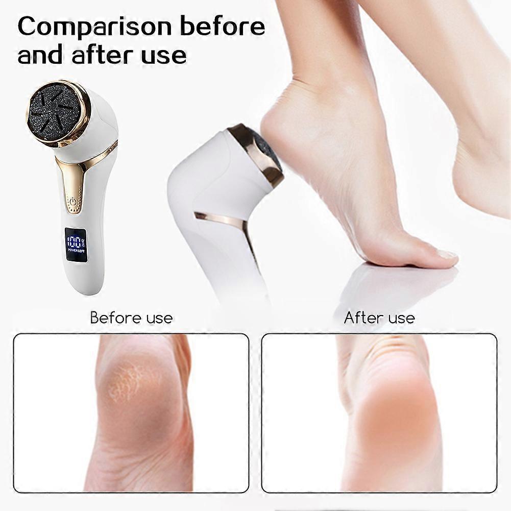 Foot Dead Skin Callus Remover Electric Filer Tool for Feet Pedicure Easy Use with Vacuum Cleaner Digital Display