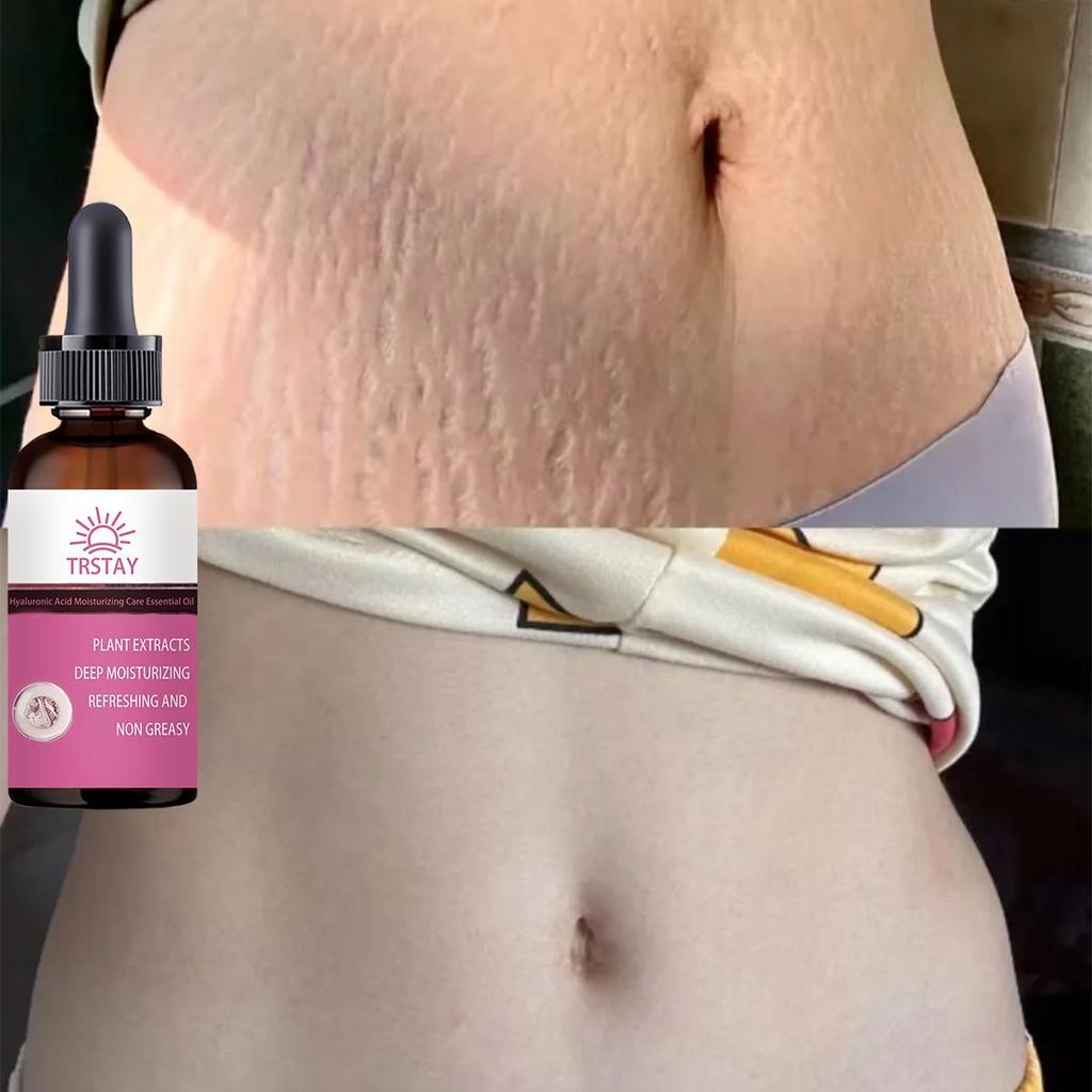 Těhotné ženy opravují břišní vrásky, poporodní opravný krém, preventivní tělový krém, hydratuje pokožku, odstraňuje těhotenské vrásky, tukové vrásky, krém na obličej