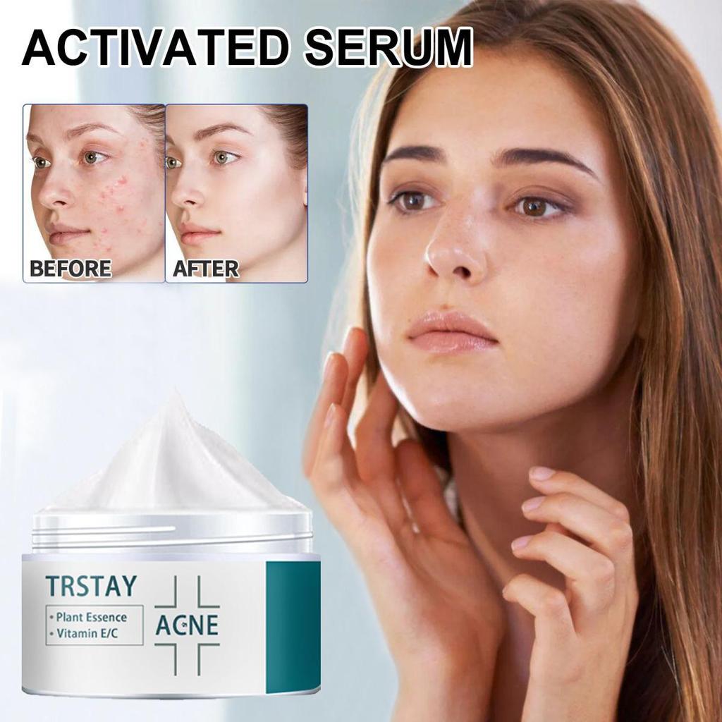 The Cream Is Gentle and Non-irritating, Firms the Skin, Brightens the Complexion, Reduces Markings, Hydrates and Nourishes the Skin