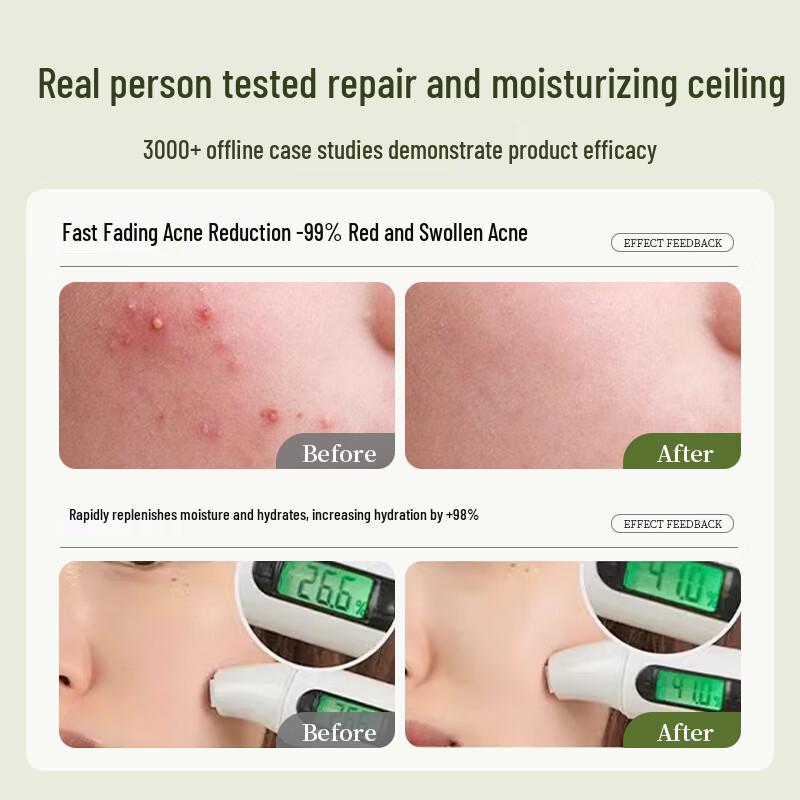 BEAUTY NOTES Natural Aloe Vera Gel