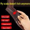 Oil Control Hair Comb: No-Wash, Anti-Dandruff, Press To Remove Oil.