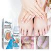 Nail Repair Spray Repair And Clean Nails, Hands, Feet, Soft Nails, Thicken Nails, Polish Nails100ml