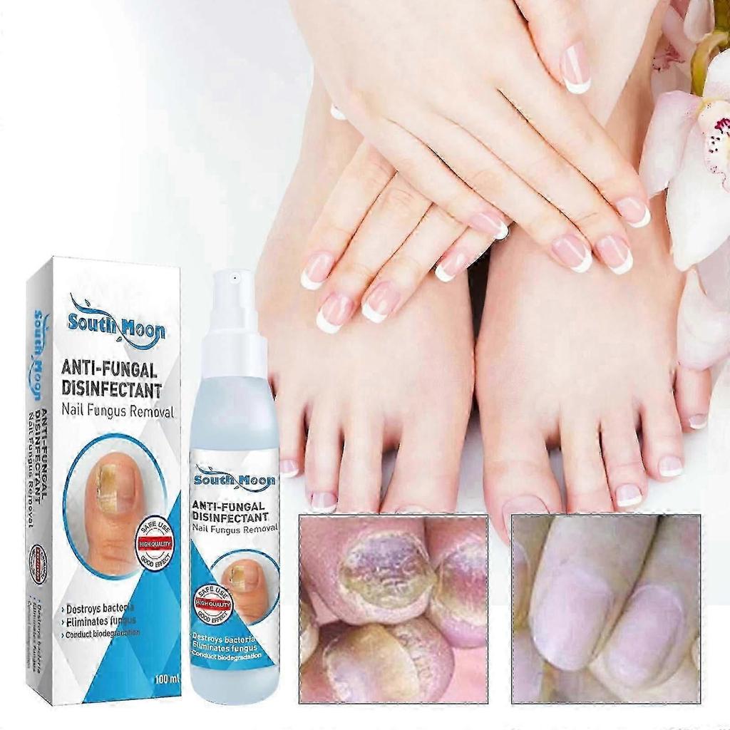 Nail Repair Spray Repair And Clean Nails, Hands, Feet, Soft Nails, Thicken Nails, Polish Nails100ml