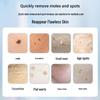 Handheld Mole and Spot Removal Pen for Beauty Salons