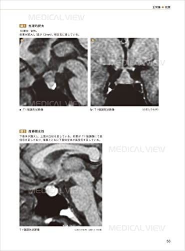 Pituitary gland imaging