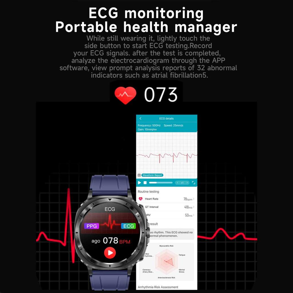 2025 Fashion New Expert Level Health Smart Watch Men ECG+PPG Laser Monitor Uric Acid Blood Fat Blood Pressure NFC HD Call Watch