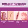 Ouhoe Scar Care Cream For Smoothing And Moisturizing Skin With Gentle Formula