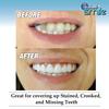Instant Smile Teeth Comfort Fit
