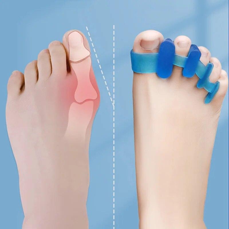 Toe Valgus Corrector Separator Hallux Bunions Finger Separator Toe Corrector Fingers Feet Haluksy toe Spreader Bunion Corrector