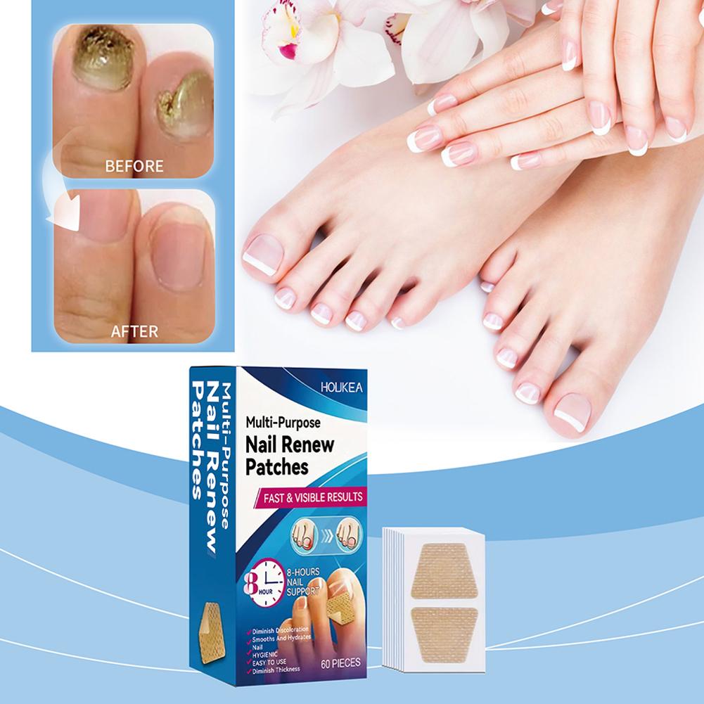 60 Stück Fußnagelpilz-Pflaster Wasserdichte Nagelreparatur-Pflaster Hühneraugen-Korrektur-Aufkleber für verfärbte und beschädigte Nägel