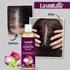 Onion Hair Oil by Ayurvedic Essentials 100ml | Strengthen Hair Roots & Nourish Hair Naturally