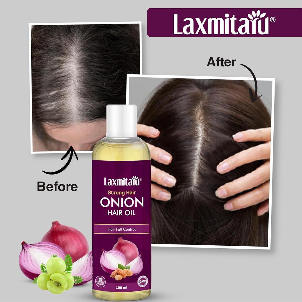 Onion Hair Oil by Ayurvedic Essentials 100ml | Strengthen Hair Roots & Nourish Hair Naturally