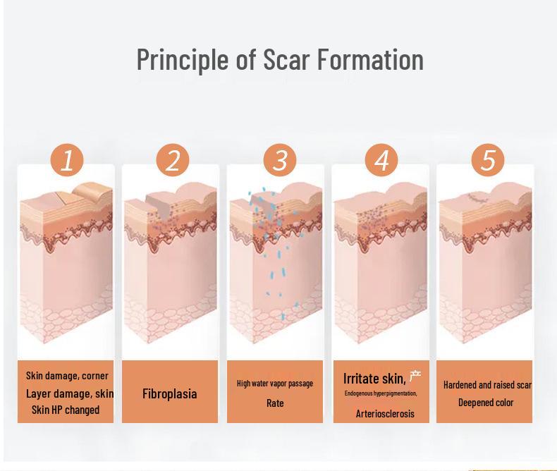 Shunaimi Silicone Gel Scar Sheet: High Elastic, Breathable, Reusable Adhesive Patch for Hypertrophic Scars.