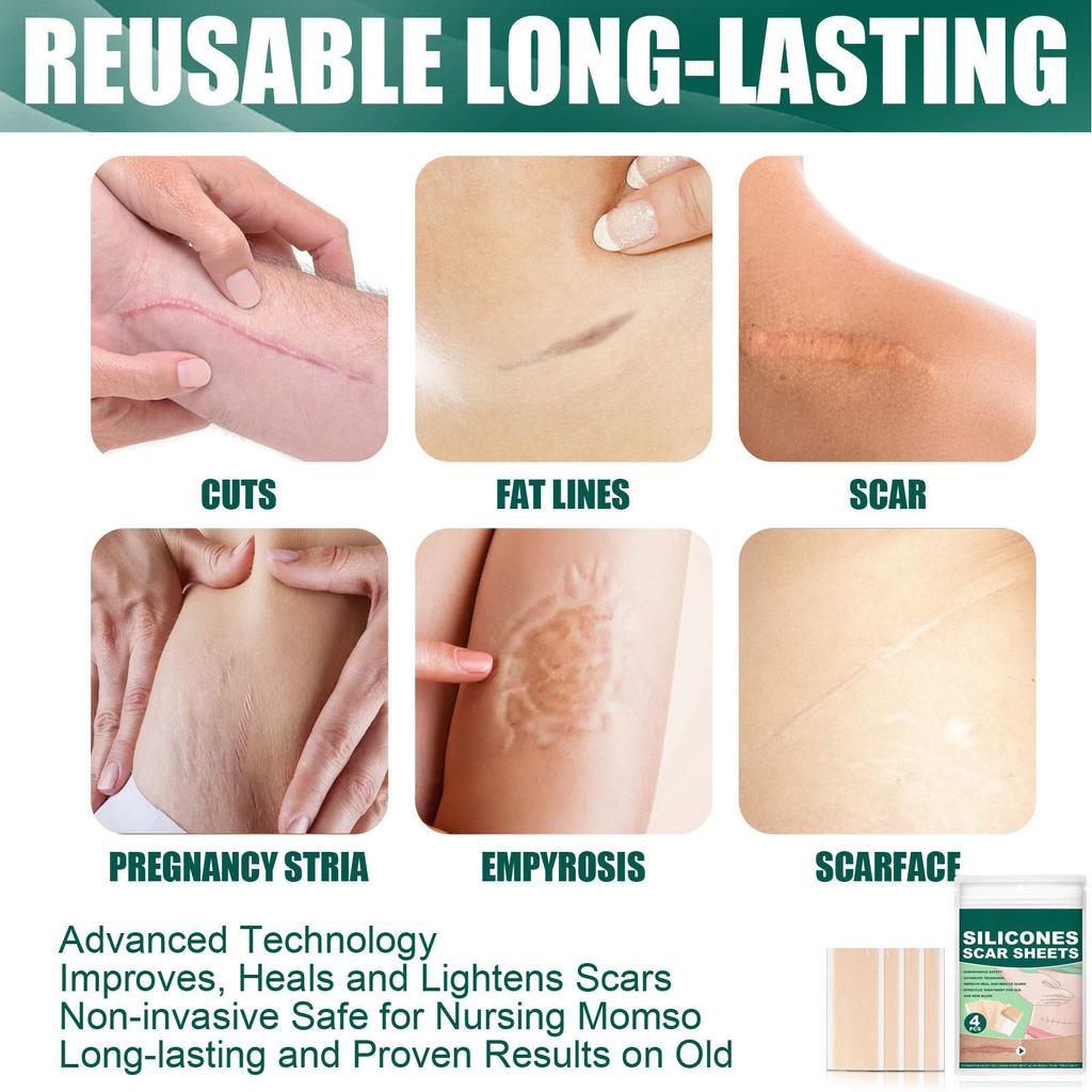 4 Pcs Scar Covering Sticker Ultra Thin Breathable Comfortable Skin Scar Concealing Tape Scar Cover Tapes