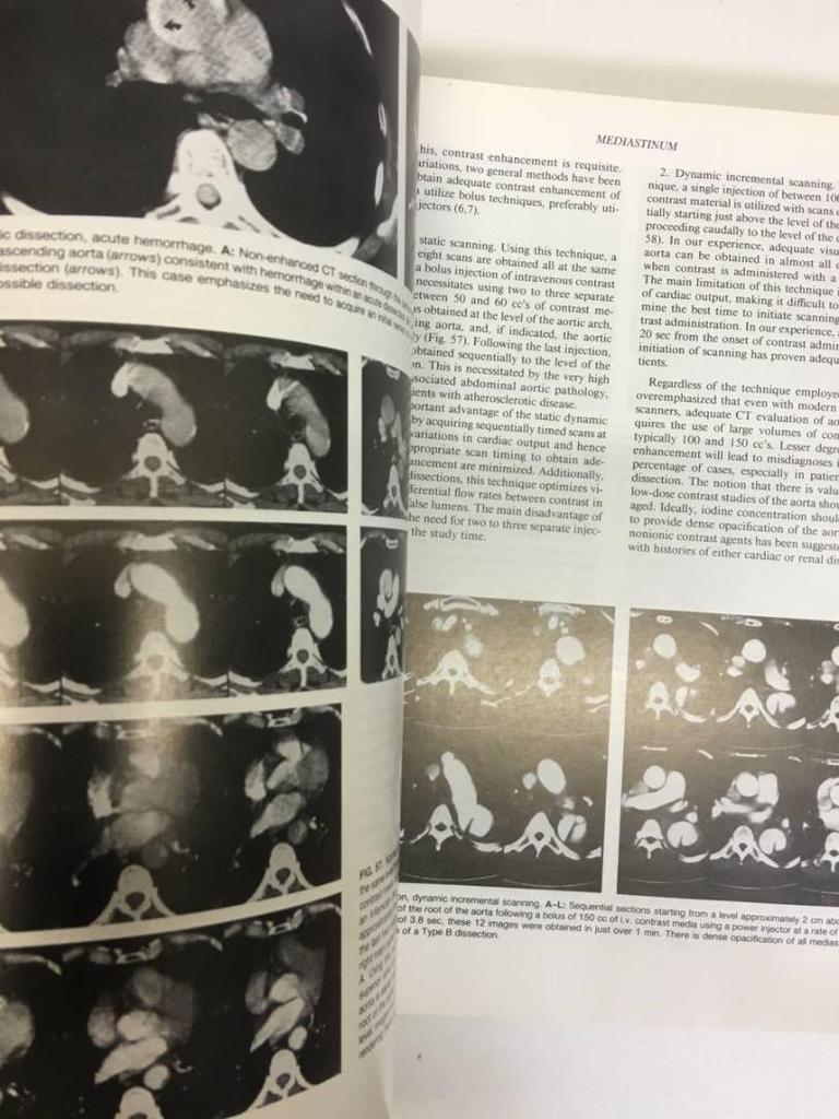 [USED] Hospital Disposal Book: Computed Tomography, Large-format Medical Book