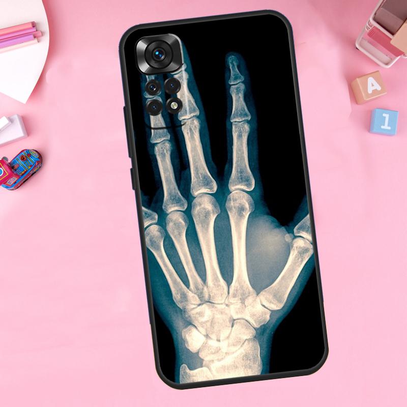 Skeleton Art For Xiaomi Redmi Note 14 10 11 12 13 15 Pro Plus Phone Case For Redmi 15 15C 14C 12C 10C 13C