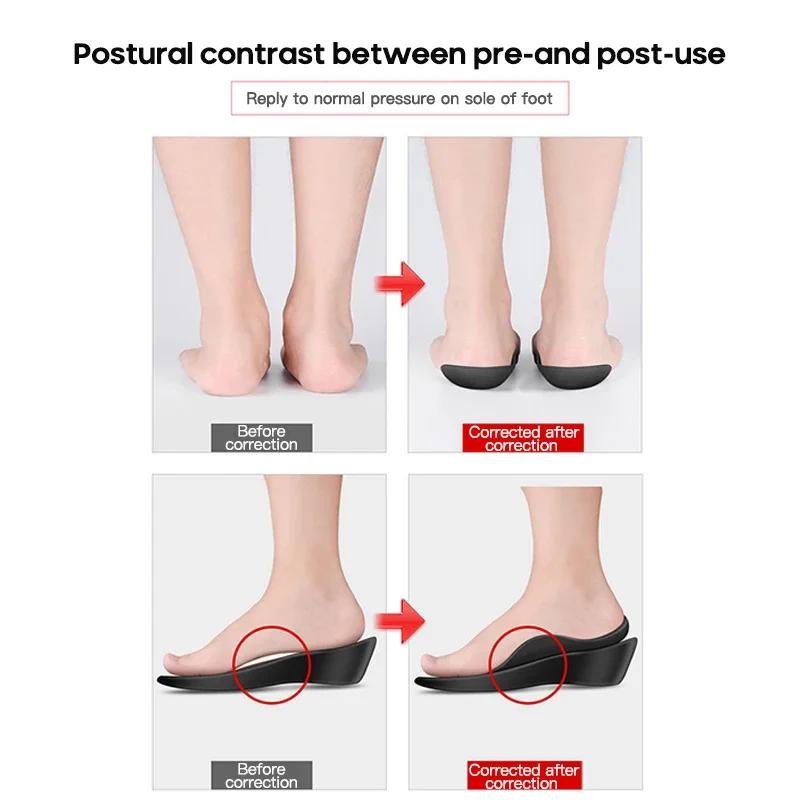 Orthopedic Insoles Orthotics Flat Foot Health Shoes Pads Arch Support Pad Plantar Fasciitis Feet Care Shoe Inserts for Woman Man