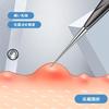 Stainless Steel Acne Needles for Blackhead Pore Acne Blackhead Dedicated Pore Care Beauty Set Removal, Care, Removal, Removal, Portable, Kit, Tool,