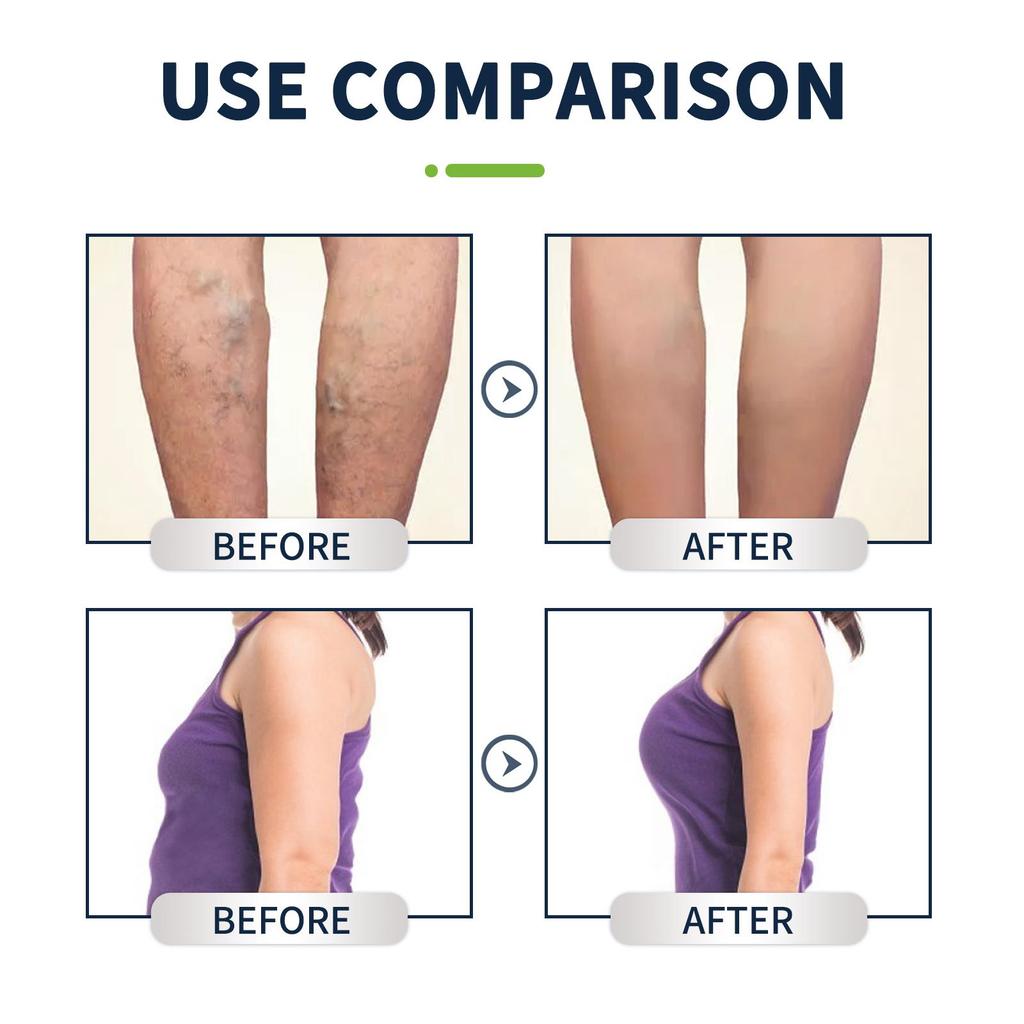 South Moon Bylinné vrecúška na kúpeľ nôh Masáž pokožky tela Spevňujúci namáčací gél na nohy Ošetrenie Vrecúška na kúpeľ nôh