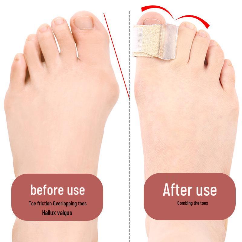 Soft Adjustable Big Toe Separator for Hallux Valgus and Overlapping Toes