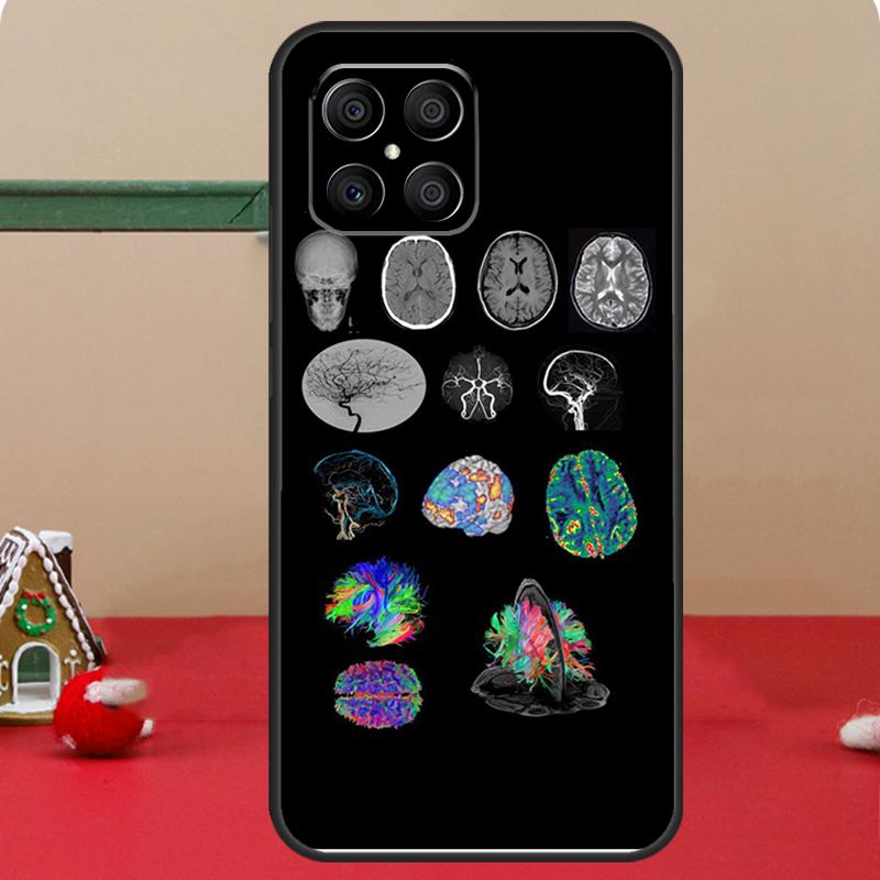Medical Human Organs Brain Case For Honor Magic 8 7 6 Pro Honor 200 400 70 90 Lite X8c X8b X9a X9b X9c X9d Win RT Coque