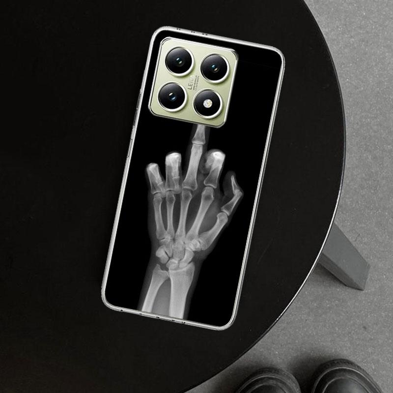 Autumu X Ray Hand Bones Phone Case Cover for Xiaomi Redmi Note 15 14 13 12 11 Pro Plus 14S 12S 11S 11T 11E 10S 10 Customized Fun