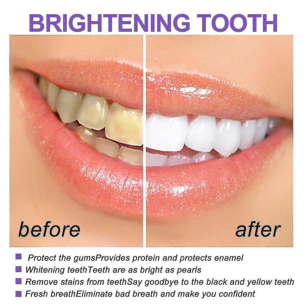 Ouhoe Purple Whitening Toothpaste Cleans Teeth Stains, Cares For Gums, Whitens Oral Breath, Freshness And Whitening Toothpaste      S 8421174915389