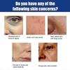 Eelhoe Blaues Kupferpeptid Essenz Set Kollagen Feuchtigkeitsspendend Und Straffend Gesichtshaut Anti-Aging Feuchtigkeitsspendende Essenz