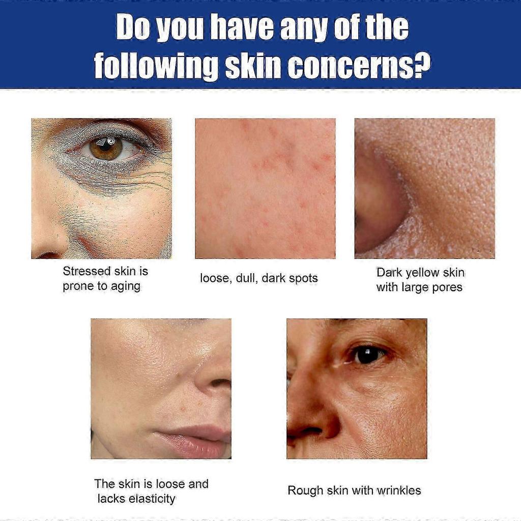 Eelhoe Blaues Kupferpeptid Essenz Set Kollagen Feuchtigkeitsspendend Und Straffend Gesichtshaut Anti-Aging Feuchtigkeitsspendende Essenz