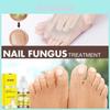 Ouhoe Gray Nail Essence With Nourishing Formula For Healthy And Beautiful Nails
