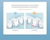 Smart Portable Electric Water Flosser: Advanced Oral Teeth Cleaning with Cross-Border Pulse Technology