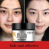 The Latest Horse Oil Freckle Cream, Fade, Stain, Sunburn, Chloasma, Freckles, Facial Care