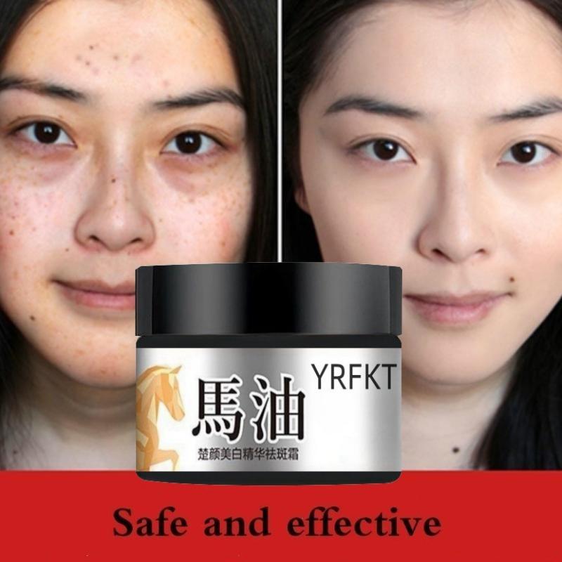 The Latest Horse Oil Freckle Cream, Fade, Stain, Sunburn, Chloasma, Freckles, Facial Care