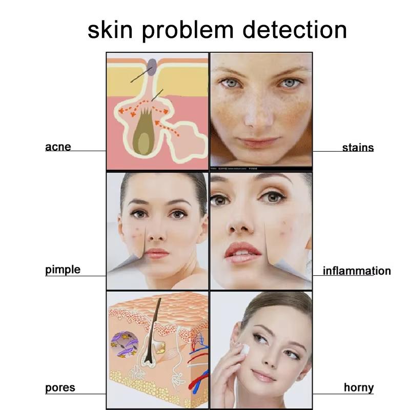 50X/200X Haarfollikel Kopfhaut Analyzer Erkennung Vergrößerungsmikroskop LCD Digital Dermatoskop Kopfhaut Haar Detektor Tester