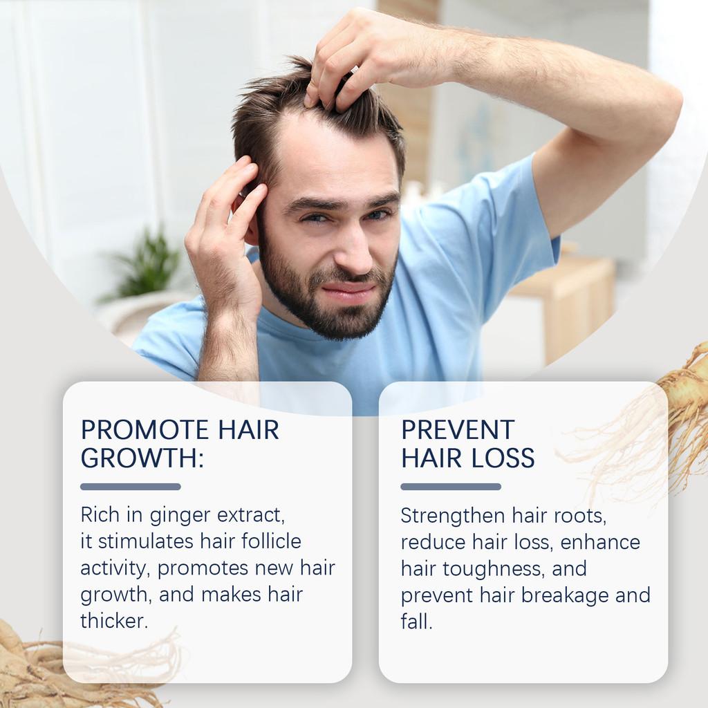 East Moon Scalp Roller Essence Nourishing Treatment For Thinning Hair Enhances Hair Density