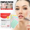 Jaysuing Colorful Acne Patches For Effective Spot Treatment And Scar Reduction 200pcs