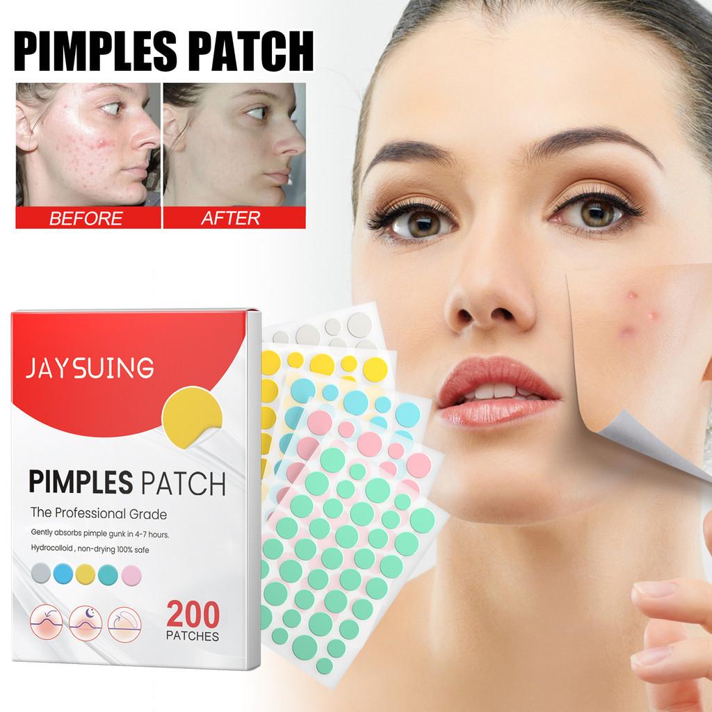 Jaysuing Colorful Acne Patches For Effective Spot Treatment And Scar Reduction 200pcs