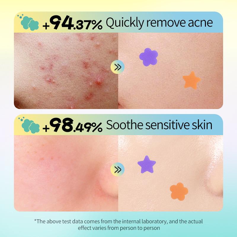 SStar-shaped Acne Patches Soothe Acne and Repair It Day and Night.