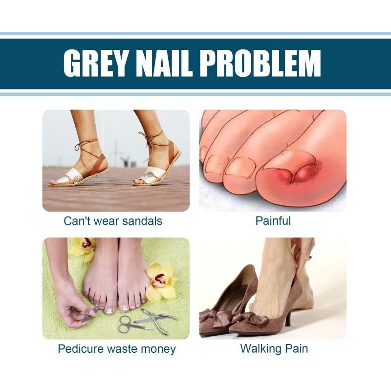 South Moon Nourishing Nail Repair Cream For Healthy Strong Nails With Moisturizing Formula