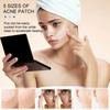 80Pcs/Set Acne Patches with Tea Tree Oil Cover Acne Scars Ultra Thin Pimple Patch Invisible Acne Spot Treatment Face Care
