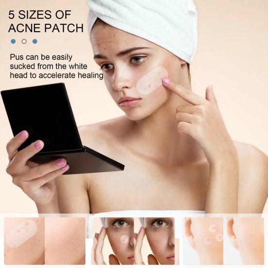 80Pcs/Set Acne Patches with Tea Tree Oil Cover Acne Scars Ultra Thin Pimple Patch Invisible Acne Spot Treatment Face Care