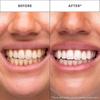 V34 Whitening Strips, Gentle Daily Teeth Cleaning and Care Strips
