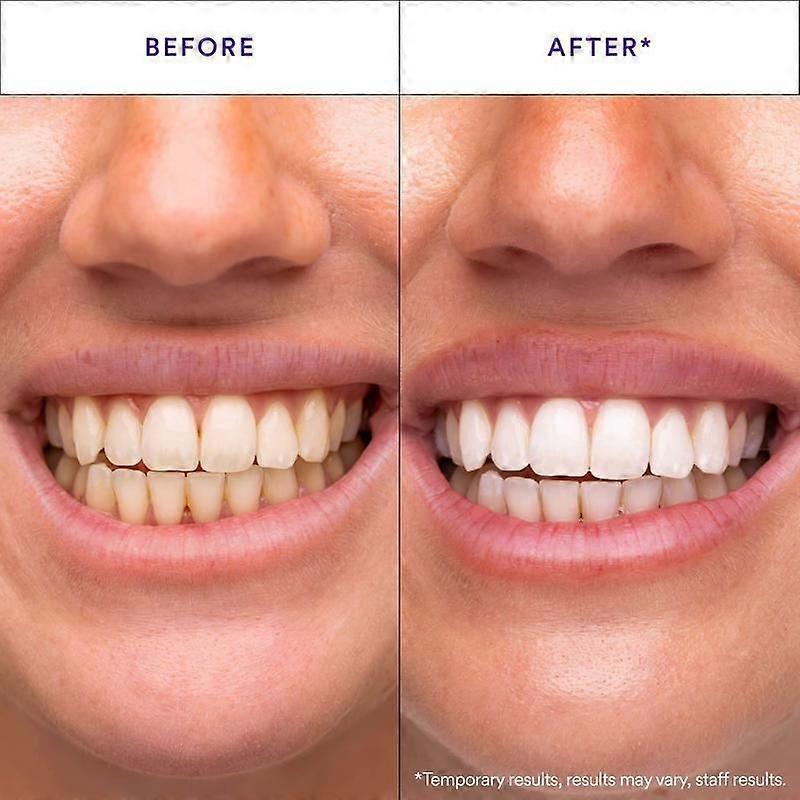 V34 Whitening Strips, Gentle Daily Teeth Cleaning and Care Strips
