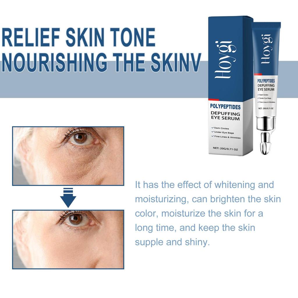 Hoygi Eye Serum: Reduces Dark Circles, Moisturizes, Refines, Tightens, and Hydrates the Eye Area.