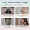 Electric Vacuum Suction Blackhead Remover Facial Pore Cleaner Comedone Spot Acne Pimple Blackhead Extractor USB Rechargeable