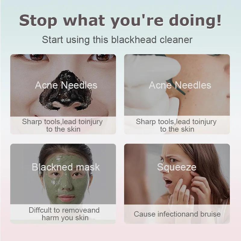 Electric Vacuum Suction Blackhead Remover Facial Pore Cleaner Comedone Spot Acne Pimple Blackhead Extractor USB Rechargeable